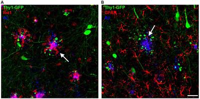 The Role of Glial Cells and Synapse Loss in Mouse Models of Alzheimer’s Disease